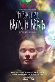 Poster My Beautiful Broken Brain